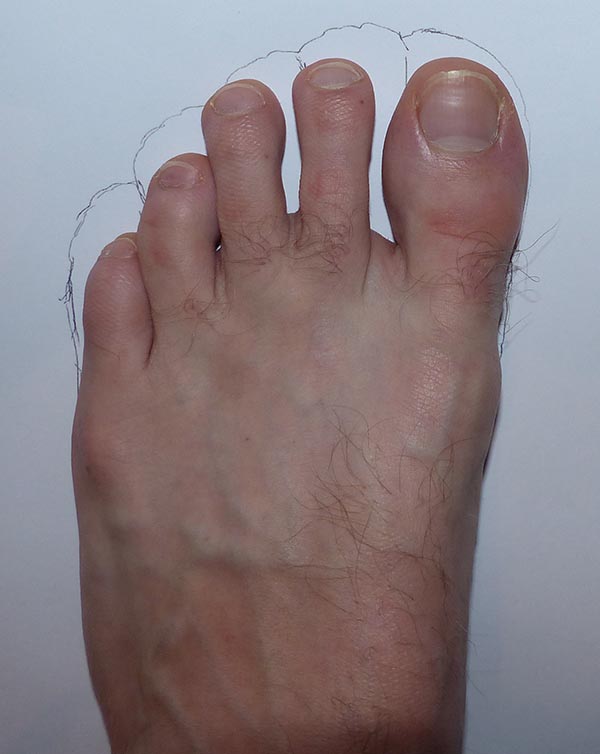 Photo d'exemple : comparaison morphologie d'un pied avec FiveFingers